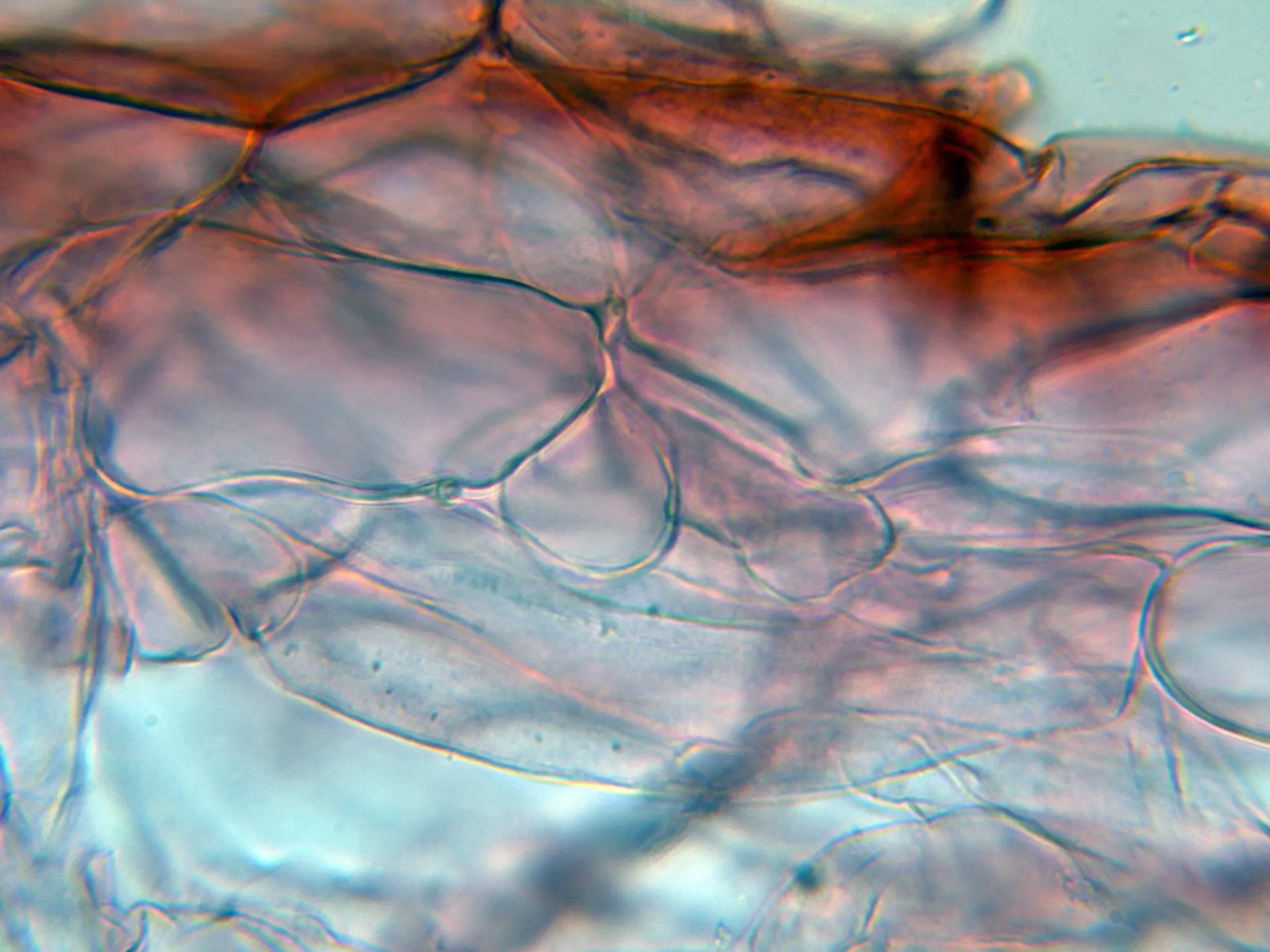 Microscopía de Mycena xantholeuca - 10 - Suprapellis-002